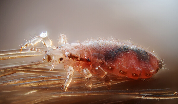 Photo: What a louse looks like